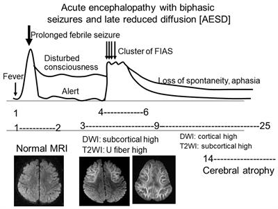 Neuroimaging in acute infection-triggered encephalopathy syndromes